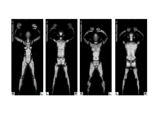 TSA scan