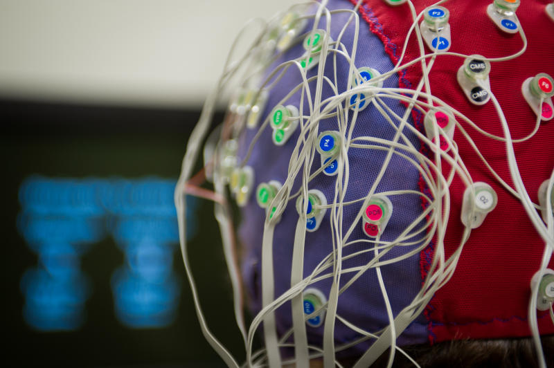 Anxiety Causes Women’s Brains To Go Into Overdrive