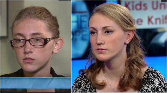 Changing Face: The Ethics Of Free Plastic Surgery For Bullying Victims
