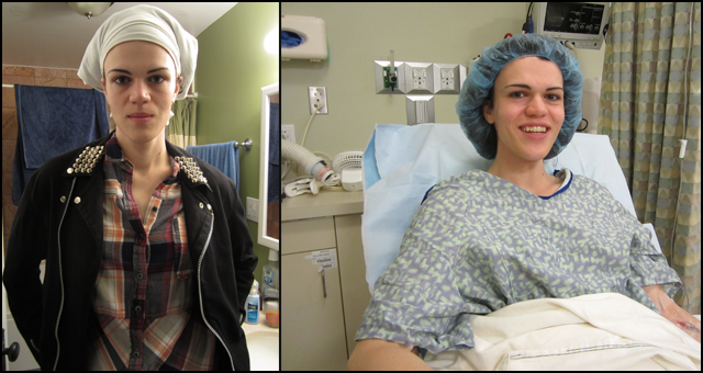 I Had Facial Feminization Surgery