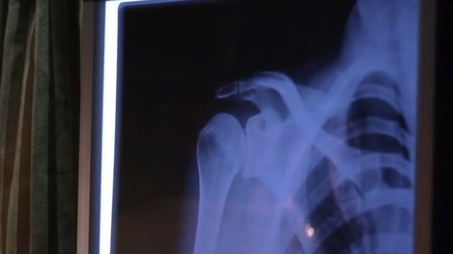 I'm no doctor scientist but this appears to be an X-Ray. That is the extent to which I can read this.