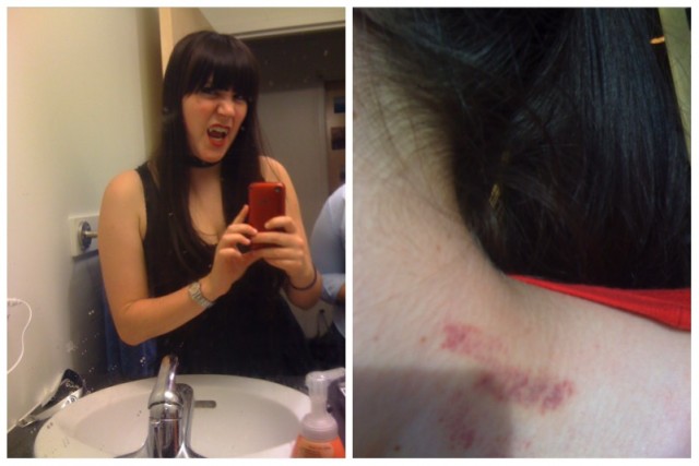 Lizz, before and after
