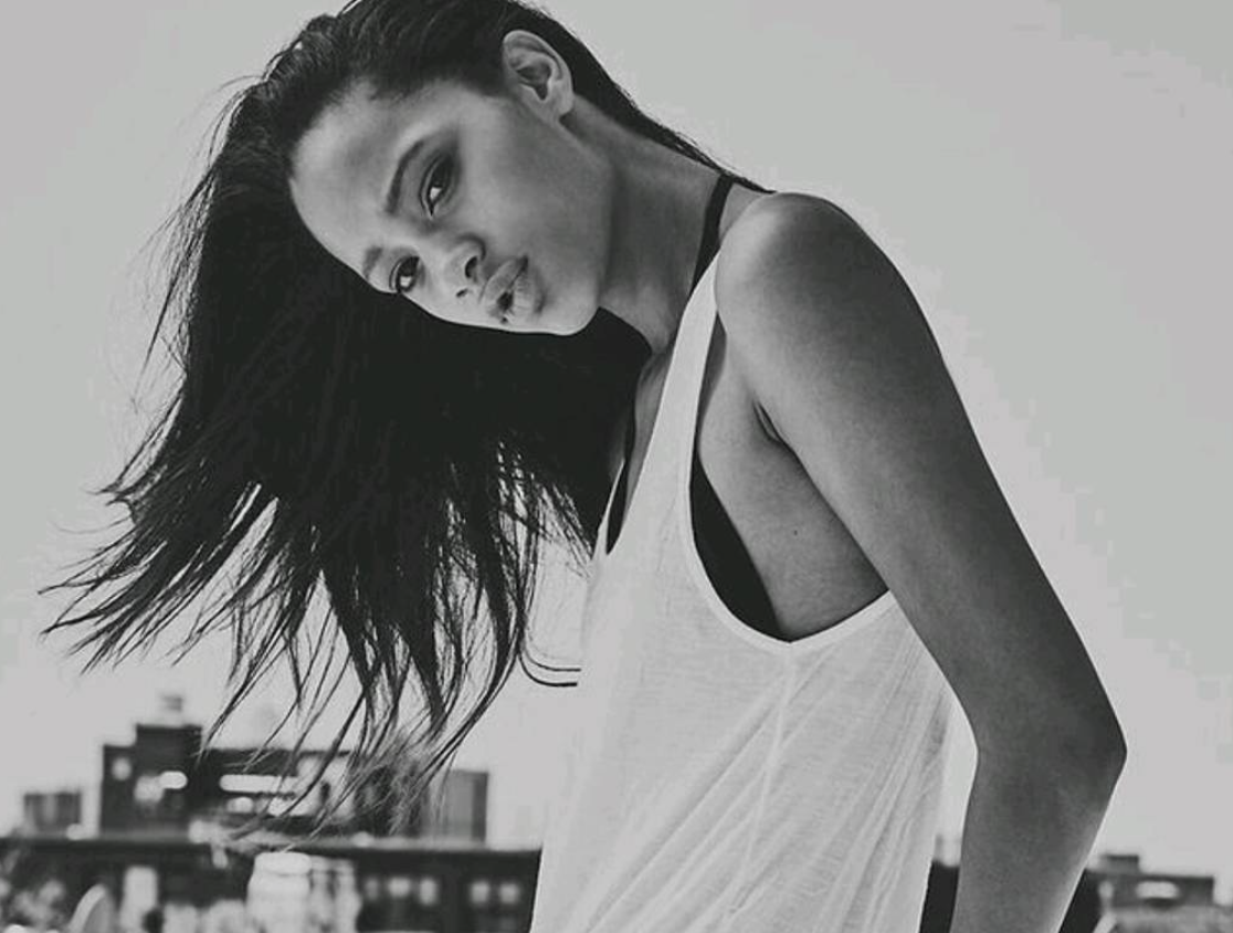 Model Selena Forrest Is Bisexual-ish, Also Removed Her Own Braces With Pliers