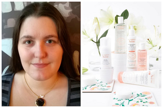 6 Over-the-Counter Eczema Treatments I’ve Tried, Ranked From Worst to Best