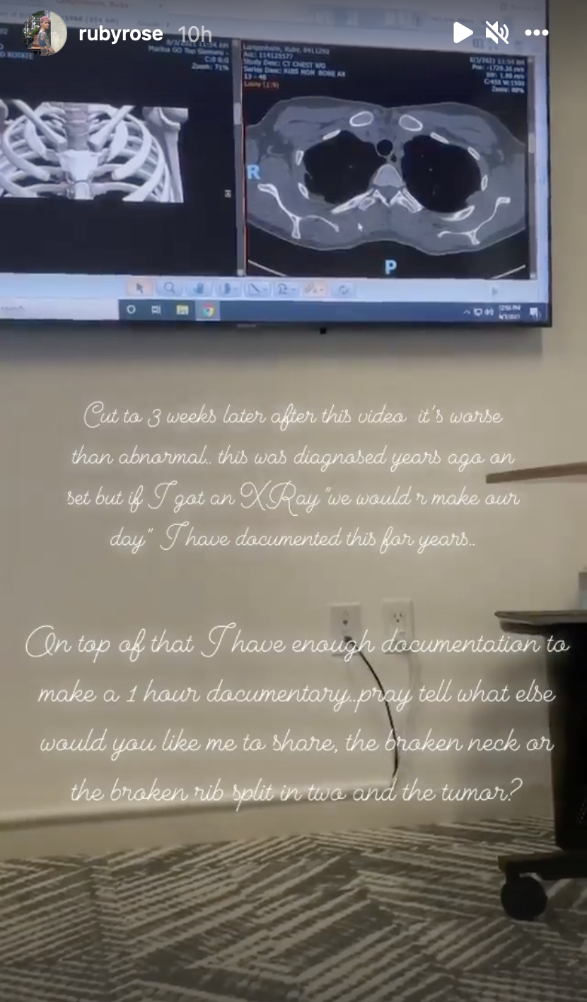 Screenshot of Ruby Rose's Instagram Live in cursive font as Rose describes their reasons for leaving Batwoman (full transcript can be found at: https://www.cbr.com/batwoman-ruby-rose-horrifying-set-conditions-slams-wbtv-berlanti/)