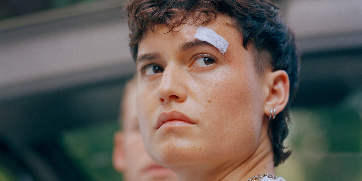 A still from "Mutt." Feña has a bandage on his head and is looking off in the distance.