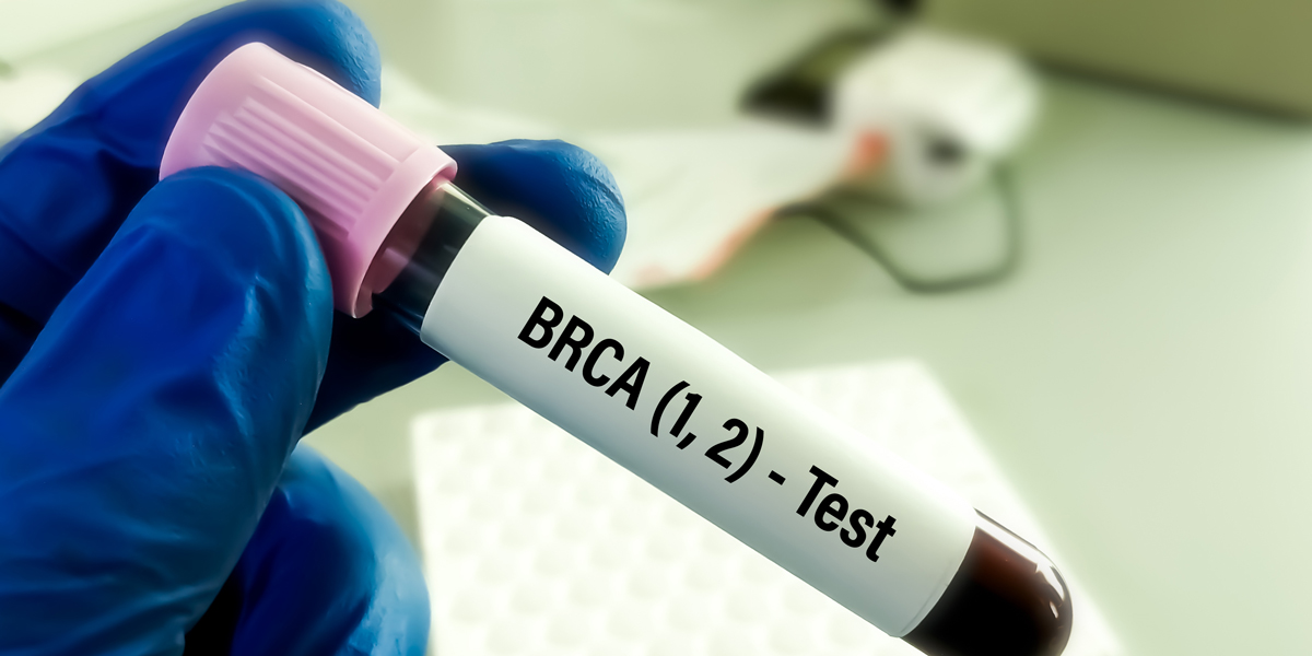What to Expect When You’re Expecting a BRCA Test