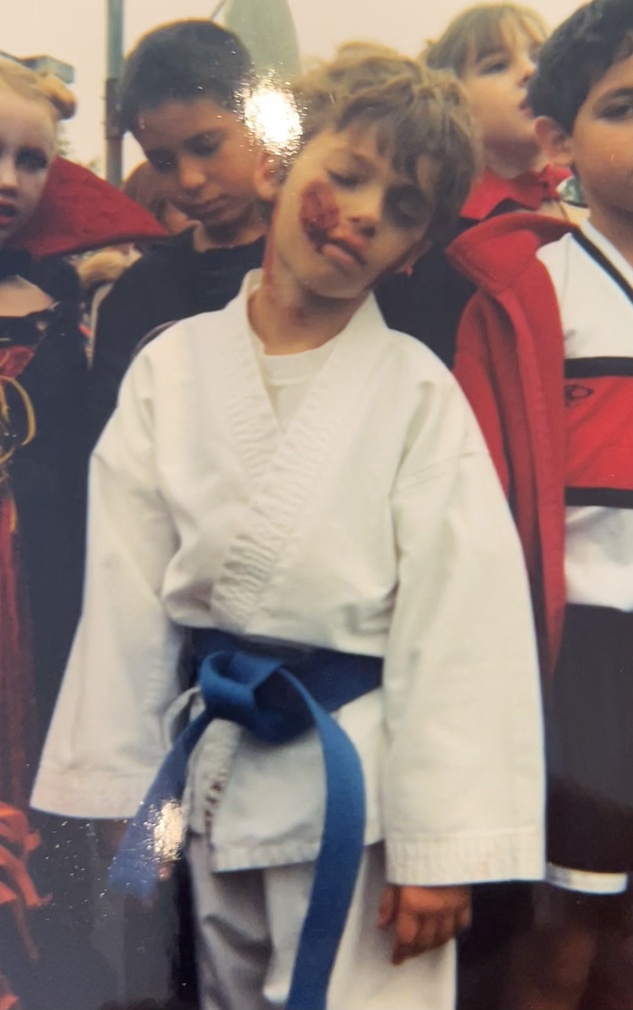Drew, age 8, dressed in a martial arts robe and blue belt with bloody wounds on her face. 