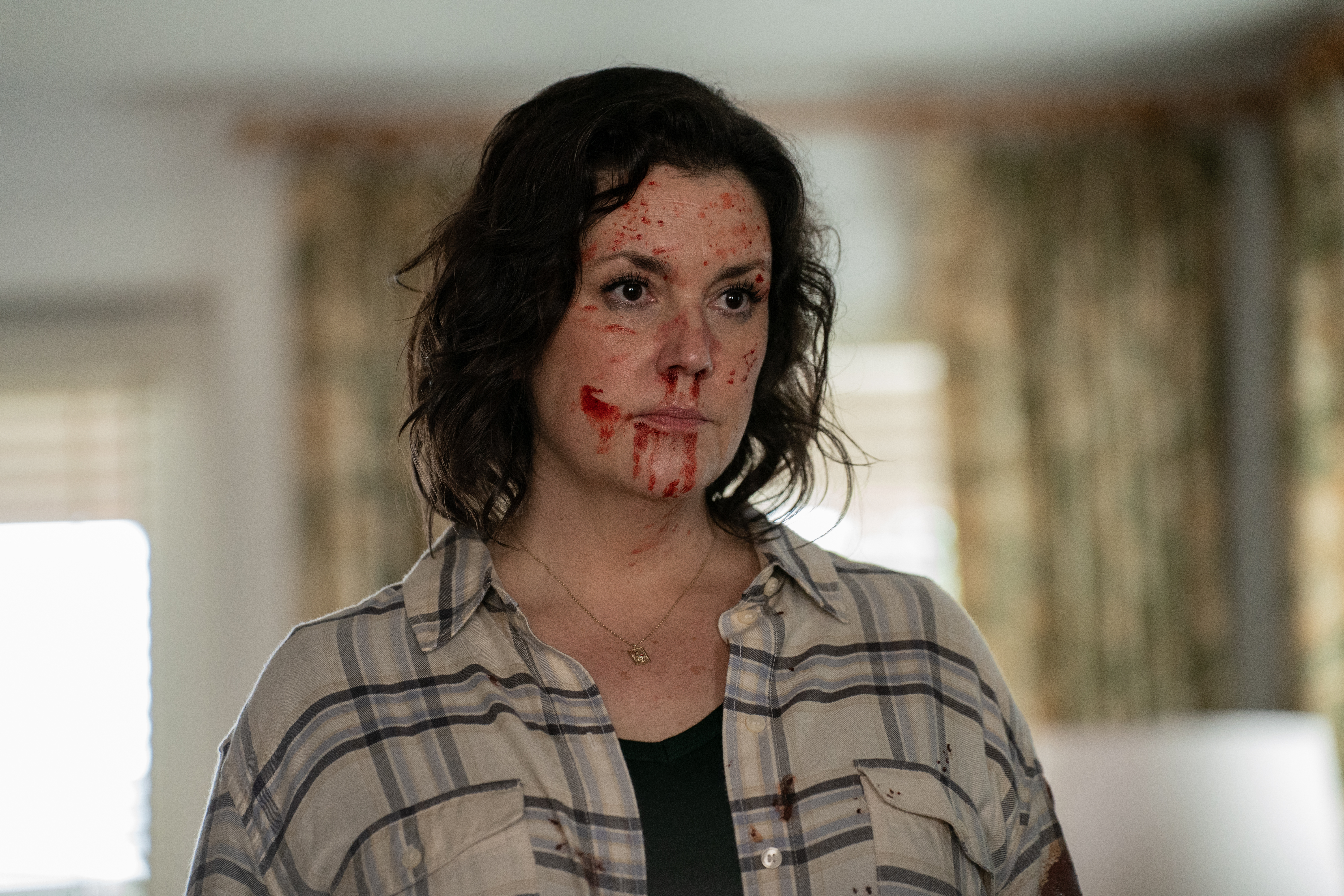 Shauna with blood on her face