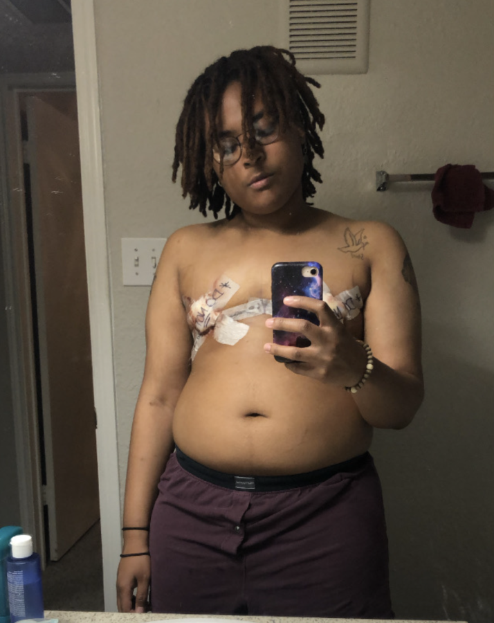 Me post-top surgery, circa 2020. 